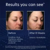 PCA Skin HydraMatte | Raseeriv näokreem rasusele nahale 50 ml