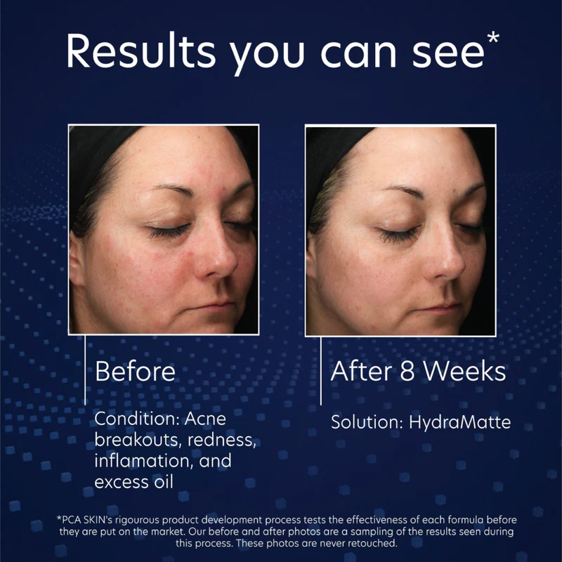 PCA Skin HydraMatte | Raseeriv näokreem rasusele nahale 50 ml