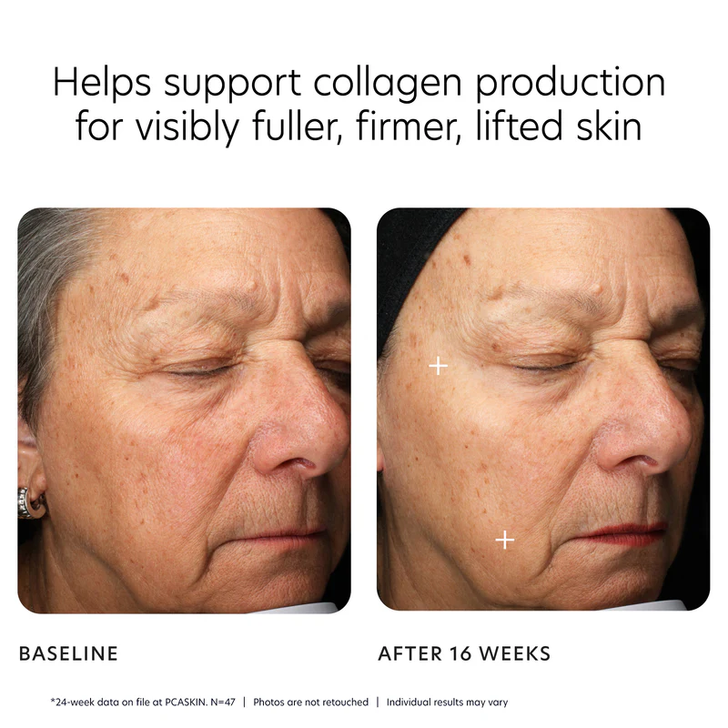 PCA Skin MGF Contour Hydrator | Näohoolduskreem Nahakindluse Tugevdamiseks 30 ml