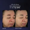 PCA Skin Pro-Max Age Renewal | Seerum Kasvufaktoritega 29 ml